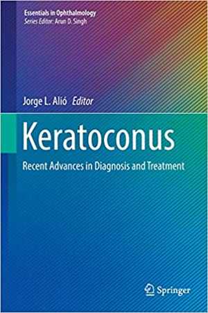 [PDF] دانلود کتاب Keratoconus - Recent Advances In Diagnosis And Treatment, 2017