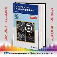 Neurosonology and Neuroimaging of Stroke 2nd Edition