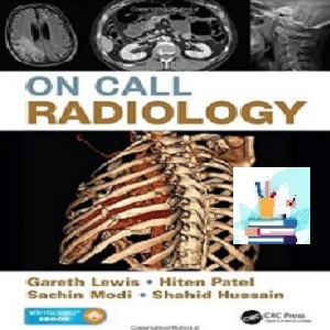 On Call Radiology TRUE PDF price 1€