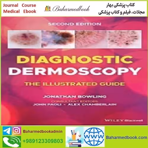 Diagnostic Dermoscopy The Illustrated Guide TRUE PDF price 1€ - کتاب پزشکی بهار