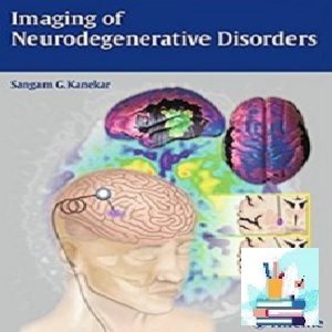 Imaging of Neurodegenerative Disorders TRUE PDF price 1€