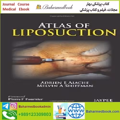 Atlas of Liposuction TRUE PDF price 1€ - کتاب پزشکی بهار