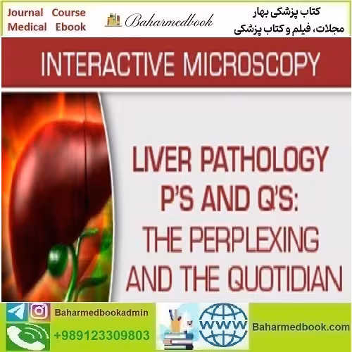 USCAP Liver Pathology P’s and Q’s The Perplexing and the Quoti