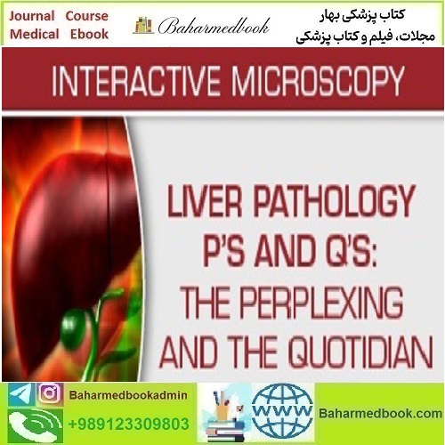 USCAP Liver Pathology P’s and Q’s The Perplexing and the Quoti