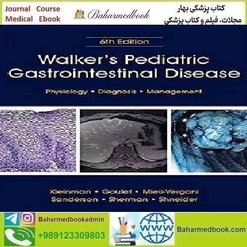 Walker's Pediatric Gastrointestinal Disease 2Vol