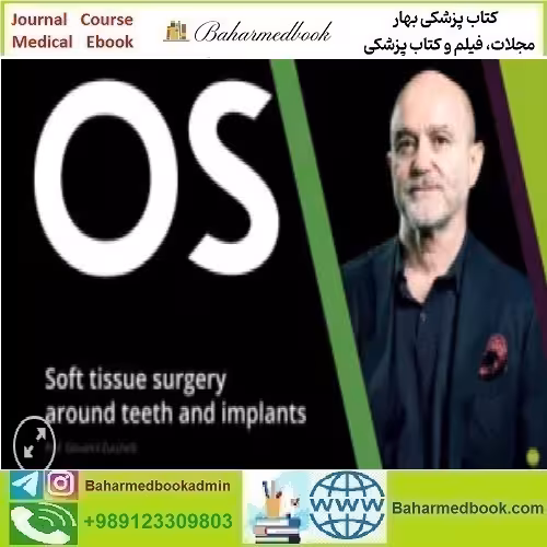 Soft Tissue Surgery Around Teeth and Implants video