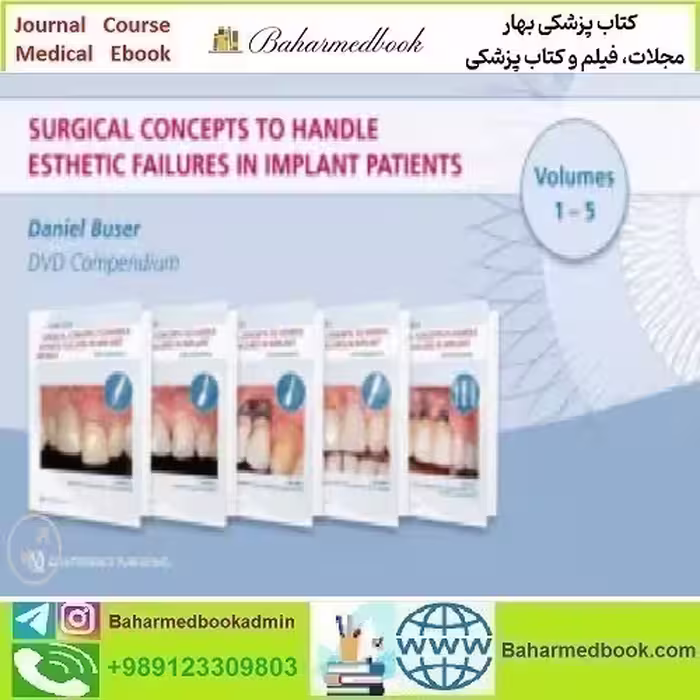 Surgical Concepts to Handle Esthetic Failures in Implant Patients