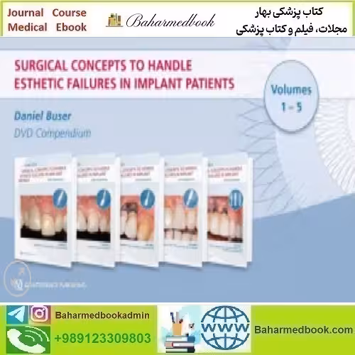 Surgical Concepts to Handle Esthetic Failures in Implant Patients