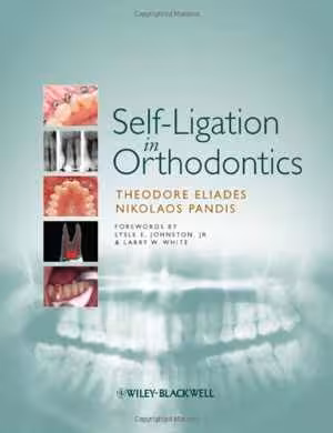 [PDF] دانلود کتاب Self-Ligation In Orthodontics, 2009