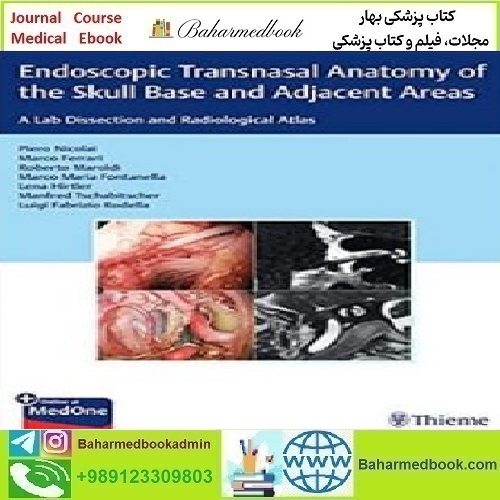 Endoscopic Transnasal Anatomy of the Skull Base and Adjace
