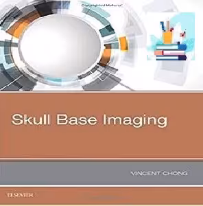 Skull Base Imaging TRUE PDF price 1€
