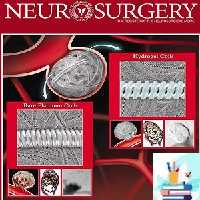 Neurosurgery 2021 Full Archives TRUE PDF at 25€ - کتاب پزشکی بهار