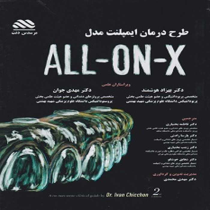 طرح درمان ایمپلنت مدل ALL ON X