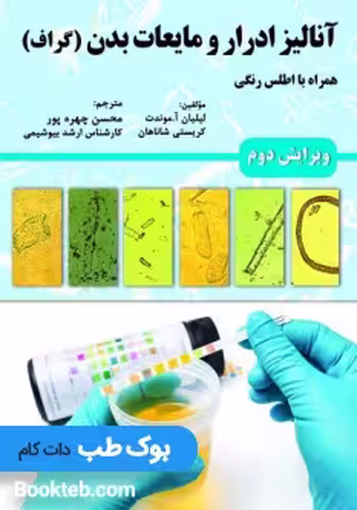 آنالیز ادرار و مایعات بدن (گراف)