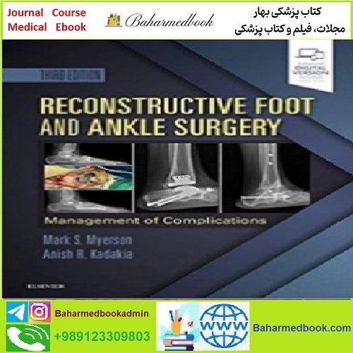 Reconstructive Foot and Ankle Surgery Management of Complica