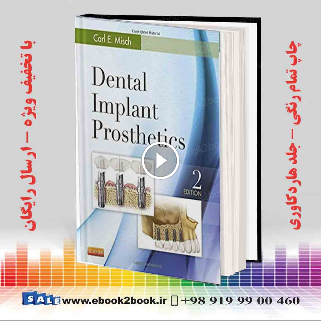 Dental Implant Prosthetics 2nd Edition