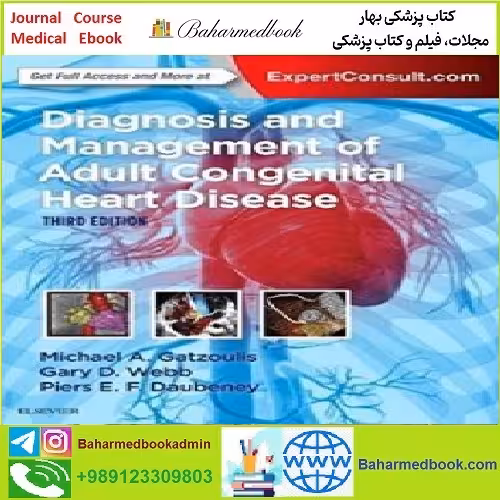 Diagnosis and Management of Adult Congenital Heart Disease
