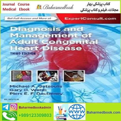Diagnosis and Management of Adult Congenital Heart Disease