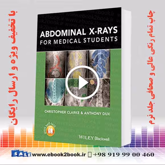 Abdominal X-rays for Medical Student