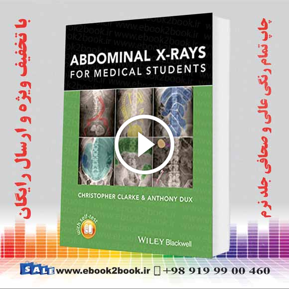 Abdominal X-rays for Medical Student