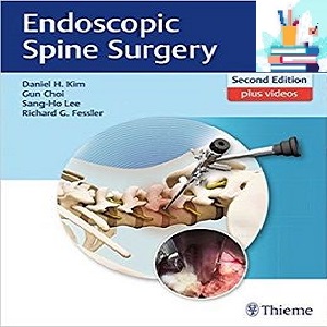 Endoscopic Spine Surgery 2ed PDF Video at 2€ - کتاب پزشکی بهار