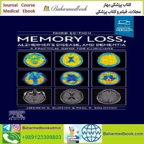 Memory Loss Alzheimer's Disease and Dementia A Practical