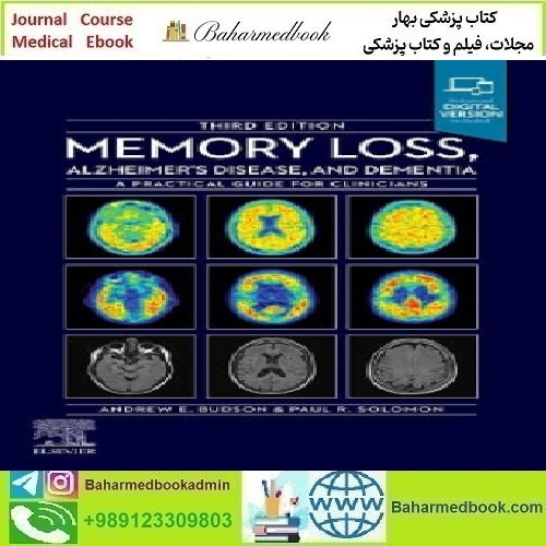 Memory Loss Alzheimer's Disease and Dementia A Practical