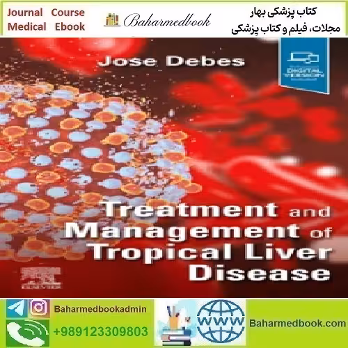 Treatment and Management of Tropical Liver Disease 2025 TRUE