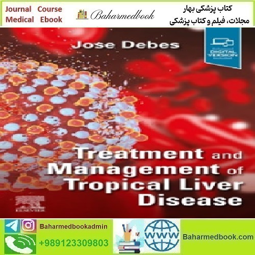 Treatment and Management of Tropical Liver Disease 2025 TRUE