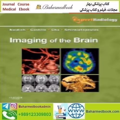 Imaging of the Brain Expert Radiology Series 201