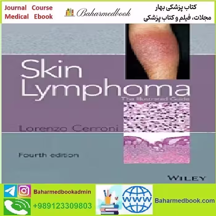 Skin Lymphoma The Illustrated Guide TRUE PDF price 1€ - کتاب پزشکی بهار