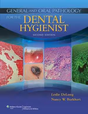 [PDF] دانلود کتاب General And Oral Pathology For The Dental Hygienist, 2nd ed, 2012