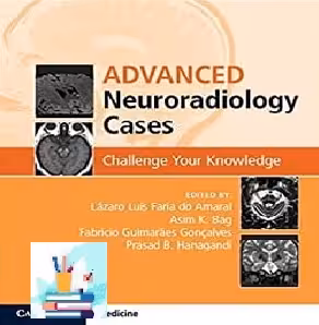 Advanced Neuroradiology Cases Challenge Your Knowledge TRU