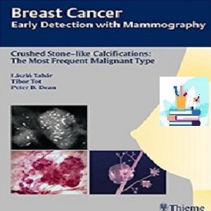 Breast Cancer TRUE PDF price 1€