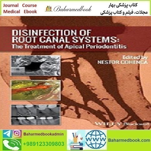 Disinfection of Root Canal Systems The Treatment of Apical Perio