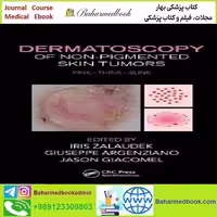 Dermatoscopy of Non Pigmented Skin Tumors TRUE PDF price 1€ - کتاب پزشکی بهار