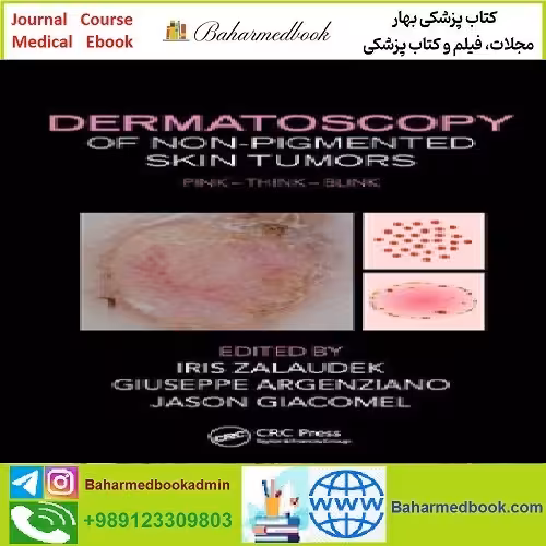 Dermatoscopy of Non Pigmented Skin Tumors TRUE PDF price 1€ - کتاب پزشکی بهار