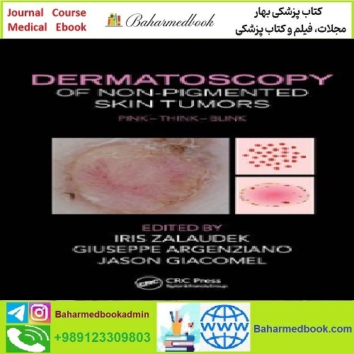 Dermatoscopy of Non Pigmented Skin Tumors TRUE PDF price 1€ - کتاب پزشکی بهار