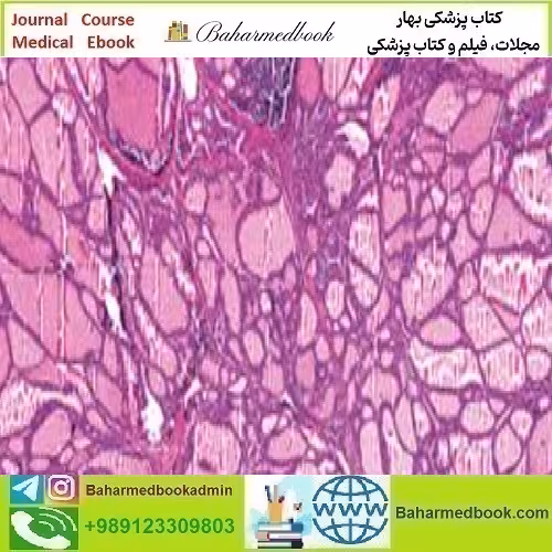 Head and Neck Pathology Masters of Pathology Series 2020 video