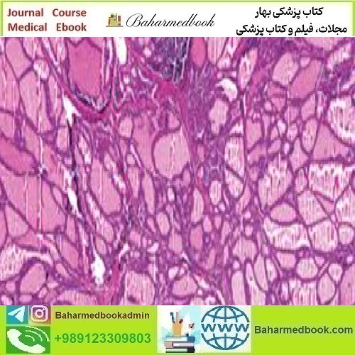 Head and Neck Pathology Masters of Pathology Series 2020 video