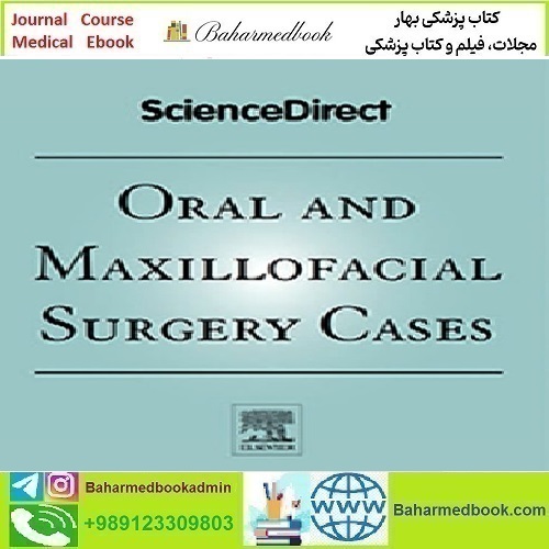 Oral and Maxillofacial Surgery Cases Volume 9 Issue 1 2023