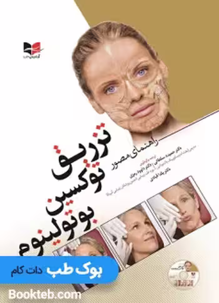 راهنمای مصور تزریق توکسین بوتولینوم