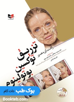 راهنمای مصور تزریق توکسین بوتولینوم