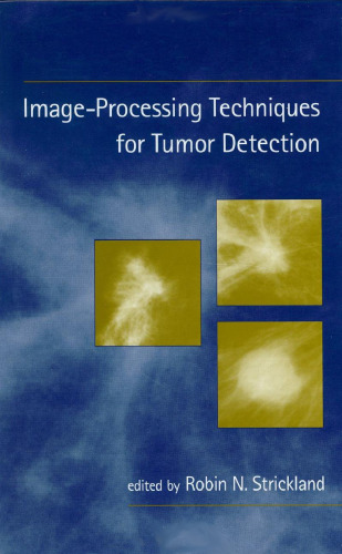 خرید و دانلود نسخه کامل کتاب Image-Processing Techniques for Tumor Detection