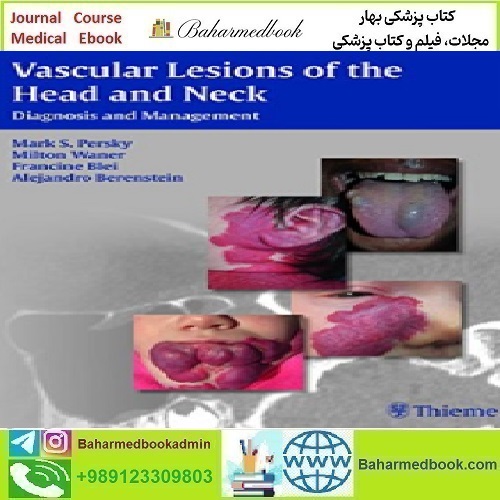 Vascular Lesions of the Head and Neck Diagnosis and Managemen