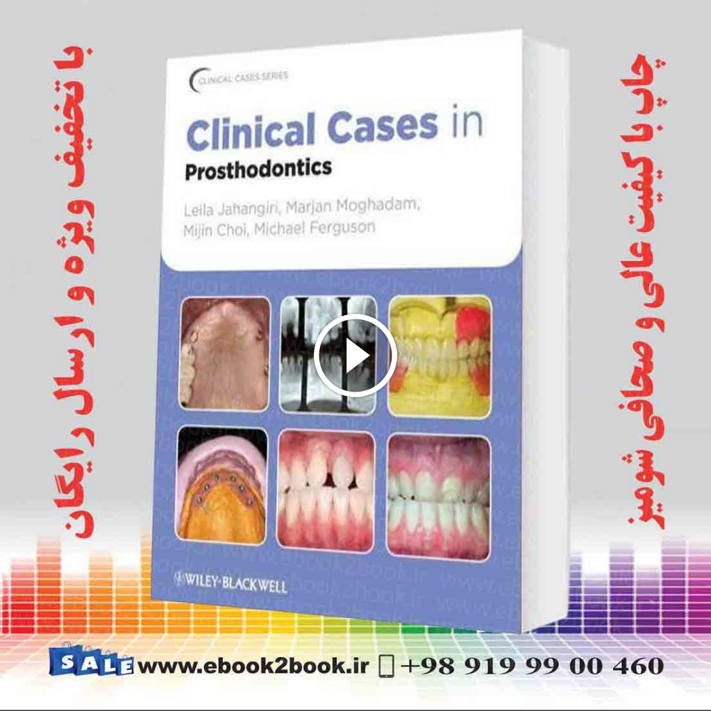 Clinical Cases in Prosthodontics
