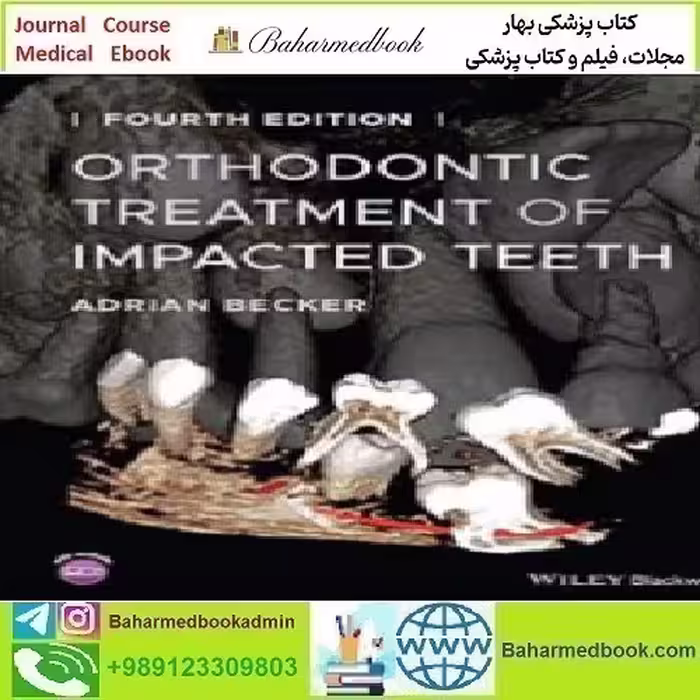 Orthodontic Treatment of Impacted Teeth 2022 TRUE PDF