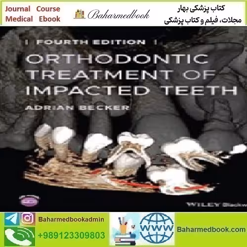 Orthodontic Treatment of Impacted Teeth 2022 TRUE PDF