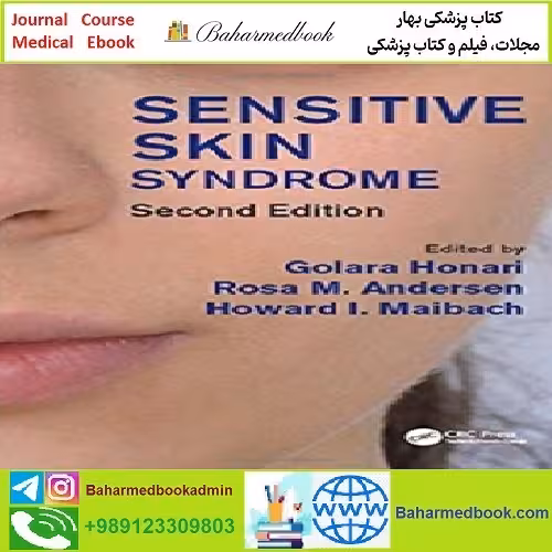 Sensitive Skin Syndrome TRUE PDF price 1€ - کتاب پزشکی بهار