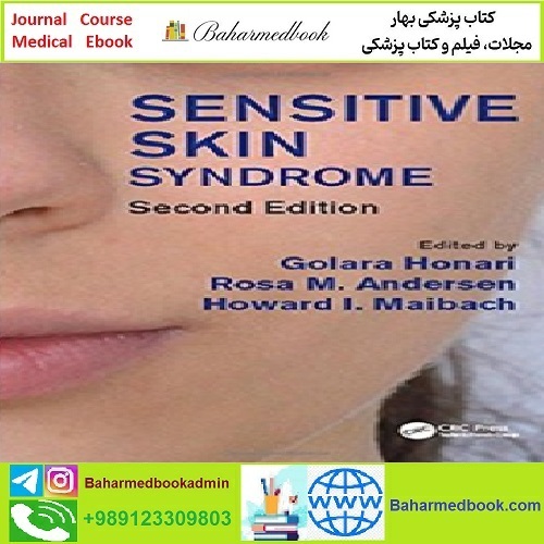Sensitive Skin Syndrome TRUE PDF price 1€ - کتاب پزشکی بهار